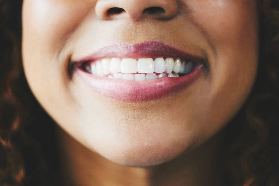 GO SMILE™ Teeth Whitening Treatment
